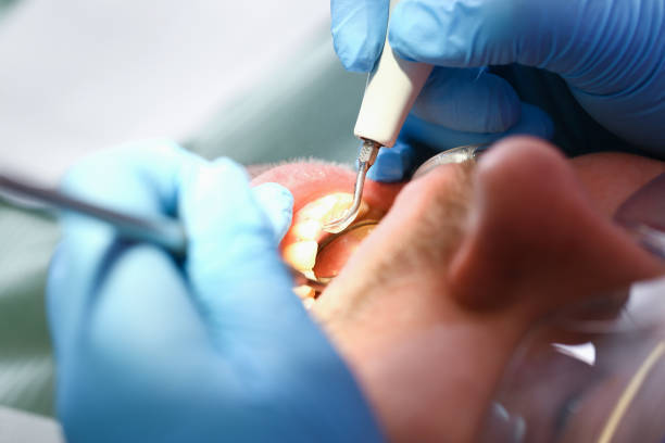 Emergency Dentist Open Today in IL